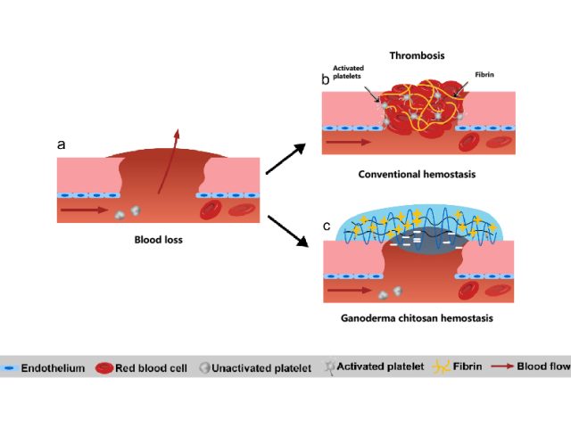 It is not dependent on the body's coagulation factors (platelets) and is more suitable for patients with coagulation disorders. GLC Coagulation effect