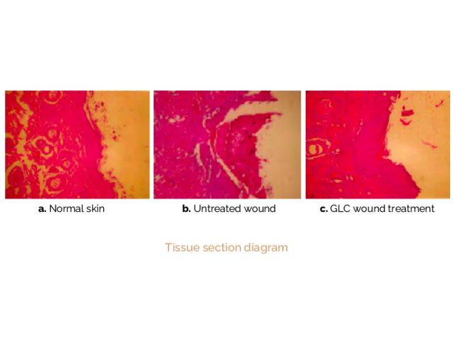 Comparative experimental wound treatment 5 days after the guinea pig trauma model tissue section found