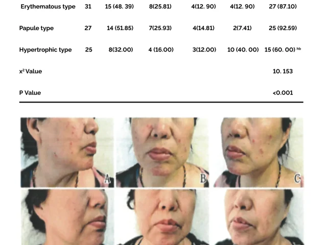 recombinant human collagen iii medical dressing